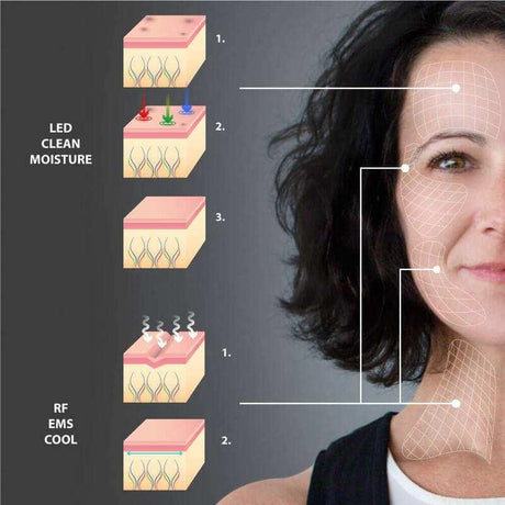 Radiofrecuencia Facial en Casa 5 en 1
