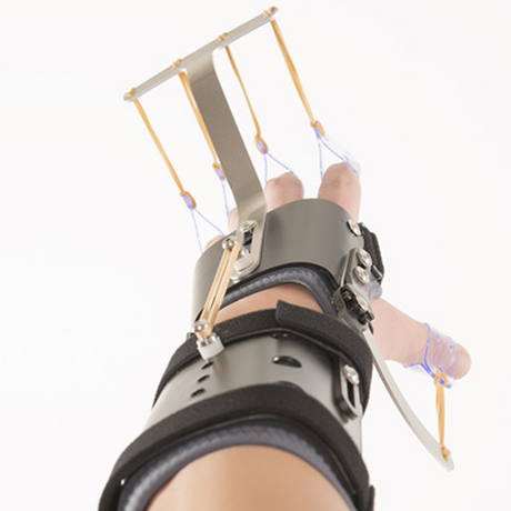 Férula Dinámica con Muñeca ARTICULADA para Lesión Nervio Radial